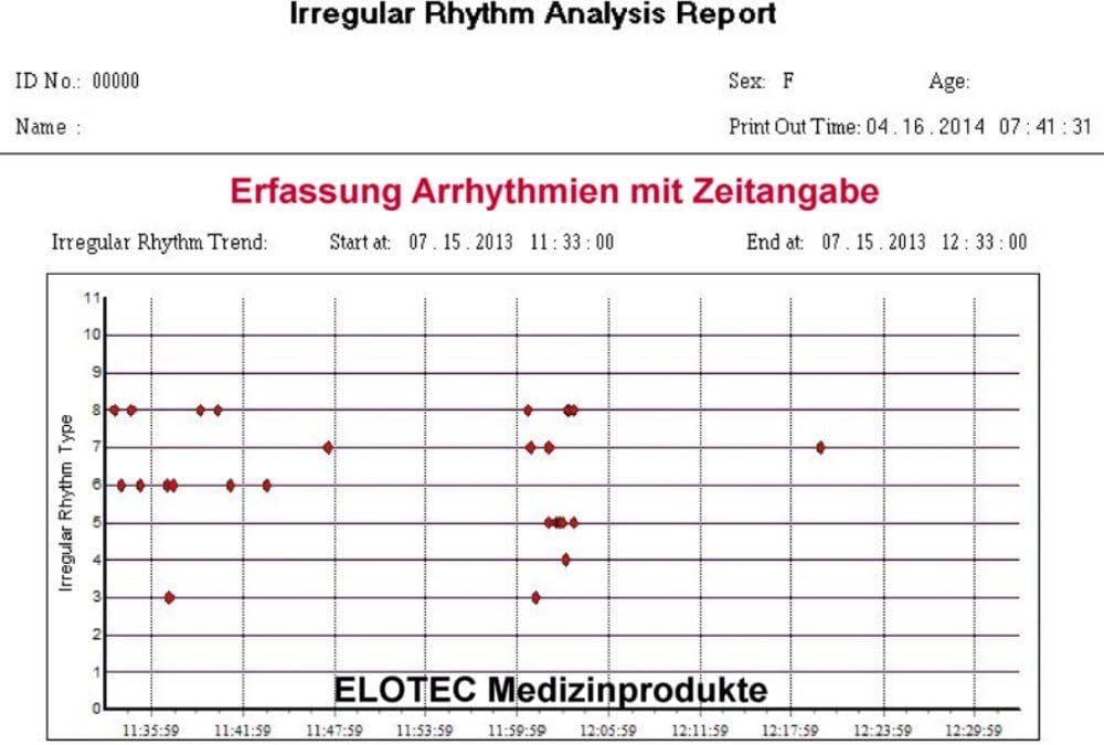 Tragbares EKG Gerät Bluetooth 30 Sekunden Handmessung-Langzeit Messung 22 Stunden mit EKG Kabel für zu Hause Vorhofflimmern-inkl. PC Auswertungssoftware ausdrucken - Deutsche Anleitung