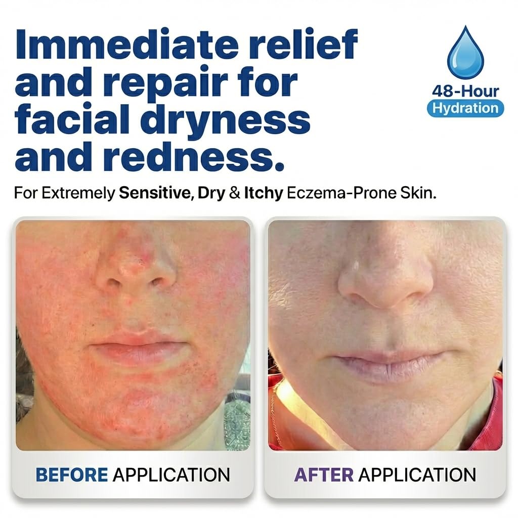 Barrier Repair & Hydrating Face Moisturizer #003 — Hypoallergenic Face Lotion for Sensitive Dry Skin — Long Lasting Hydration — Daily Moisturizer for Face — Post Procedure Recovery Cream — Made in USA - Image 7