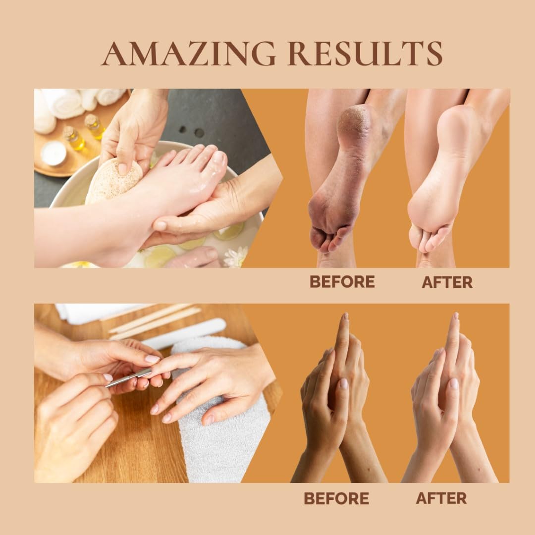 Vedic Valley Manicure Pedicure Kit for Women & Men with Foot Peeling Mask, D-Tan Scrub & Moisturizing Cream | Mani Pedi Care Kit for Repairs Cracked Heels, Removes Dead Skin, Hydrates & Nourishes Hands & Feet | Muskmelon 75gm 4