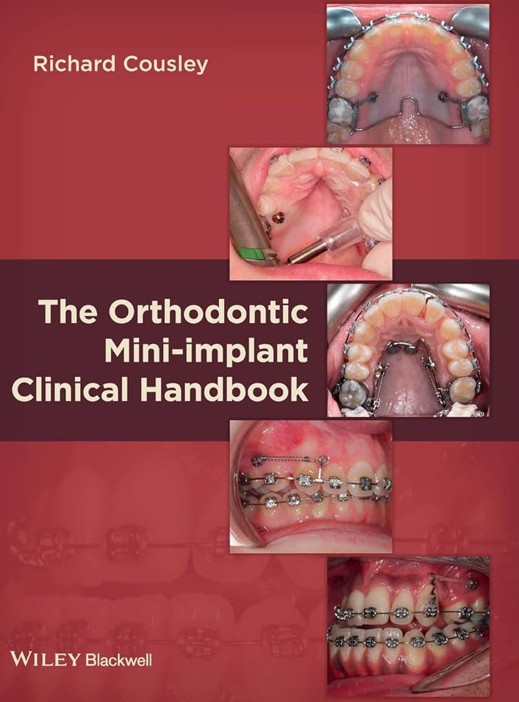 The Orthodontic Mini-implant Clinical Handbook
