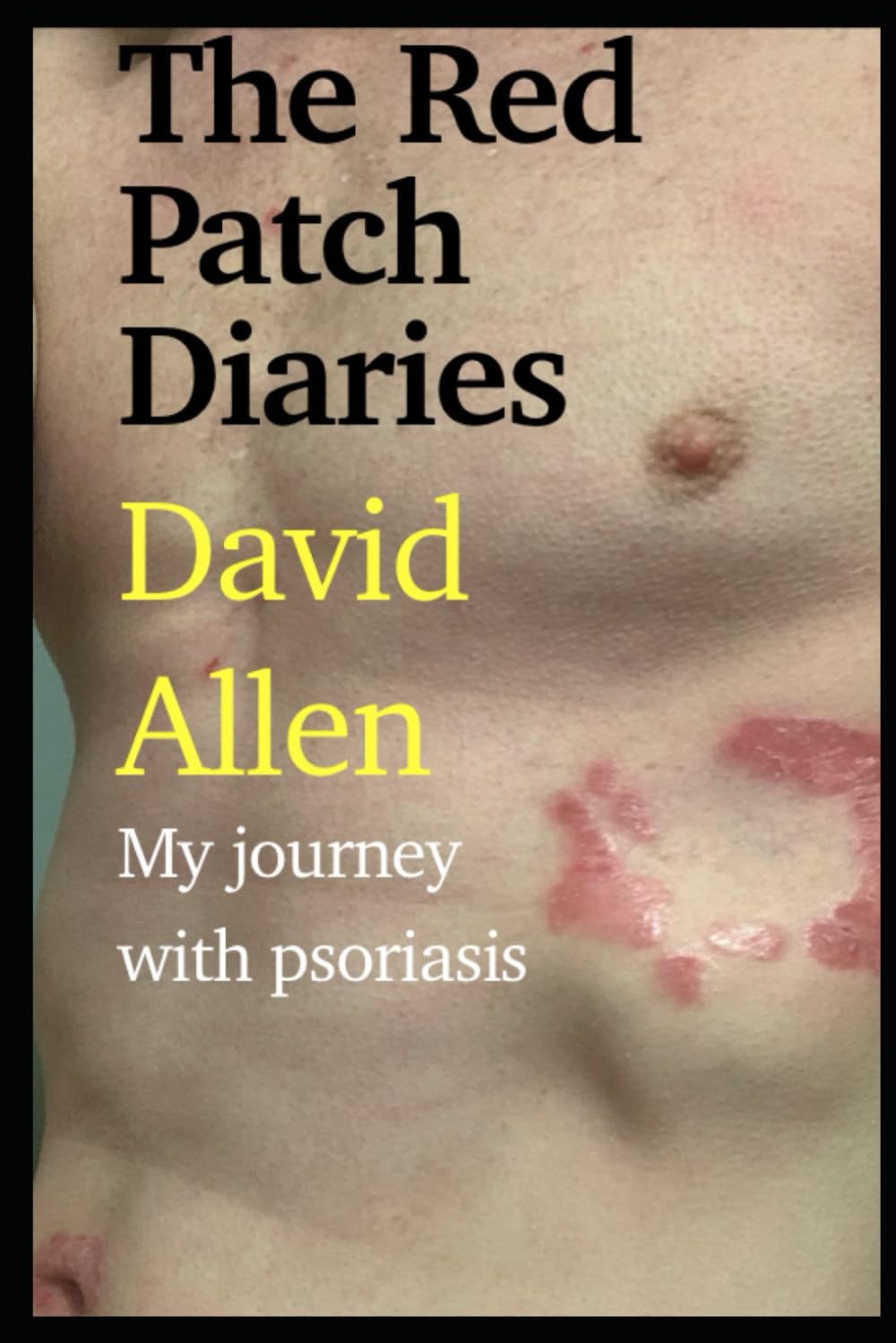 The Red Patch Diaries