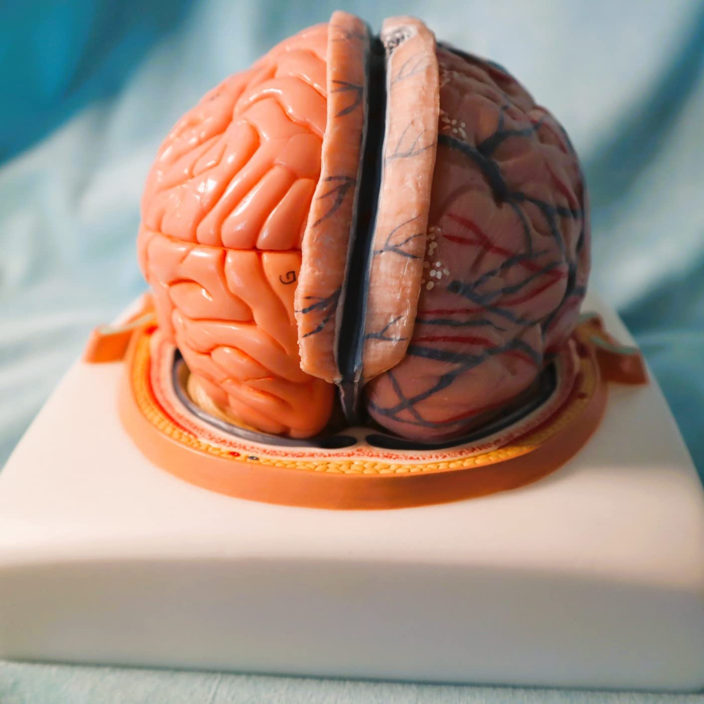Evotech Human Brain Model w/Arteries, 7 Parts Life Size Anatomy Brain ...