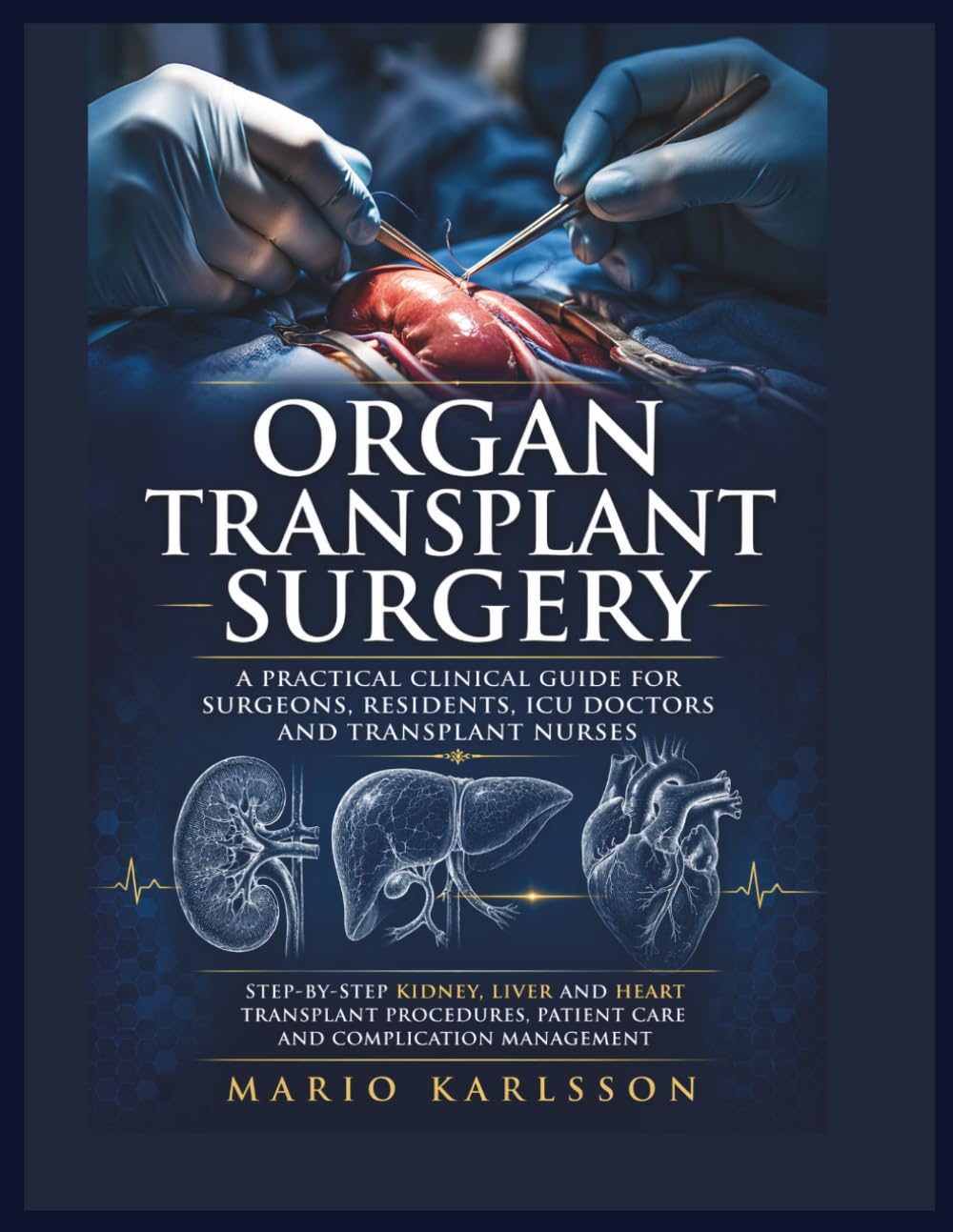 ORGAN TRANSPLANT SURGERY: A Practical Clinical Guide for Surgeons, Residents, ICU Doctors and Transplant Nurses, Step-by-Step Kidney, Liver and Heart Transplant Procedures, Patient Care and Complicati