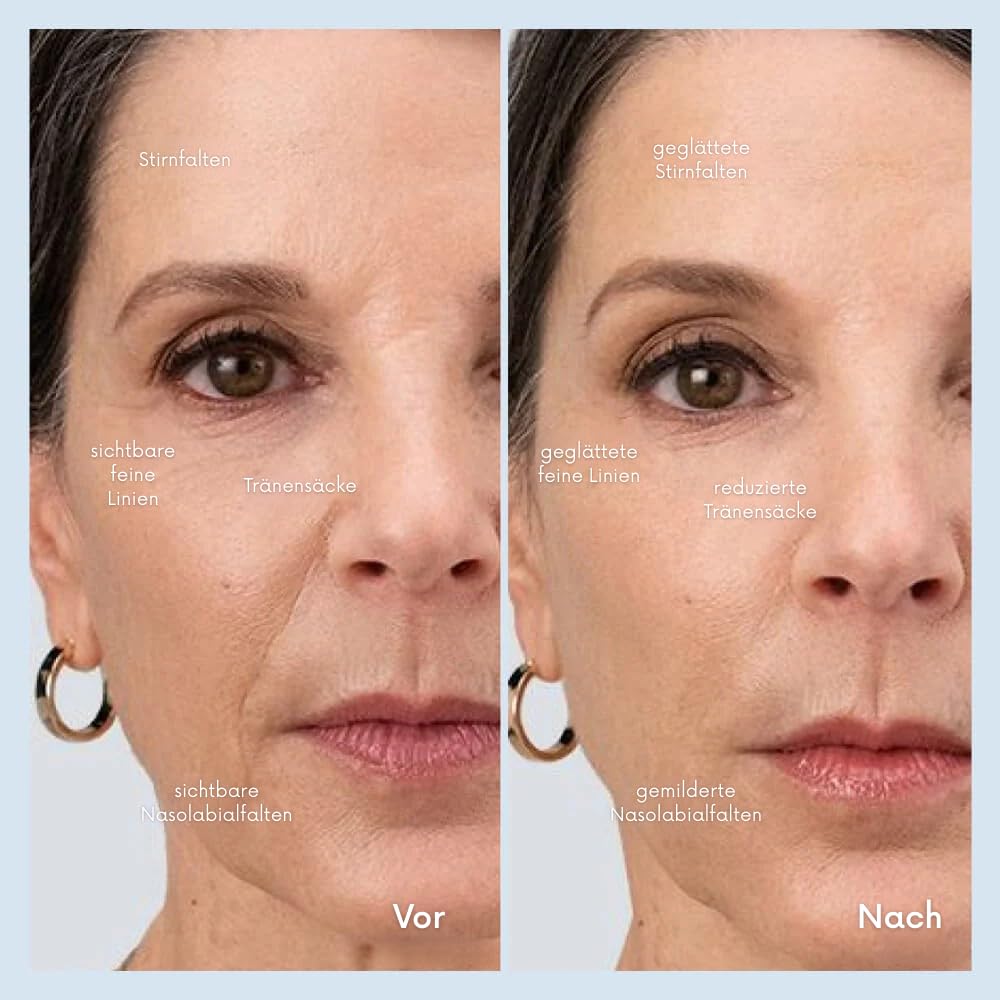 luxxiv FacialWand | Schaffen Sie eine festere, glattere und strahlendere Haut Elektrische Gesichtsreinigungsbürste – Multifunktionaler Peeling-Massagegerät für alle Hauttypen