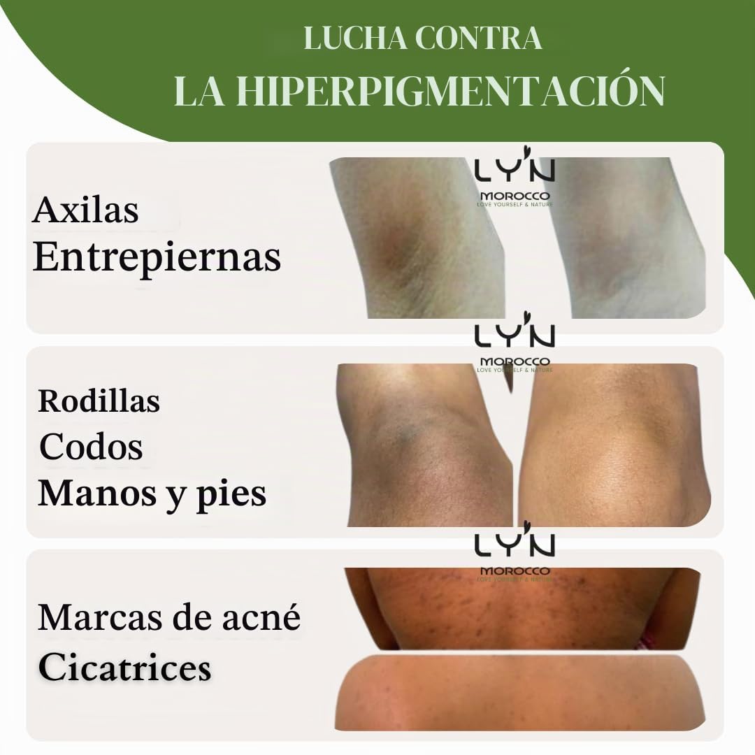 Exfoliante Corporal Brillo y Antirugosidades (Tabrima), 100%Natural y Orgánico con NILA, Oliban y Plantas-Para Queratosis, Celulitis, Desintoxicación Axilas, Antes del Bronceado y Depilación-Efectos