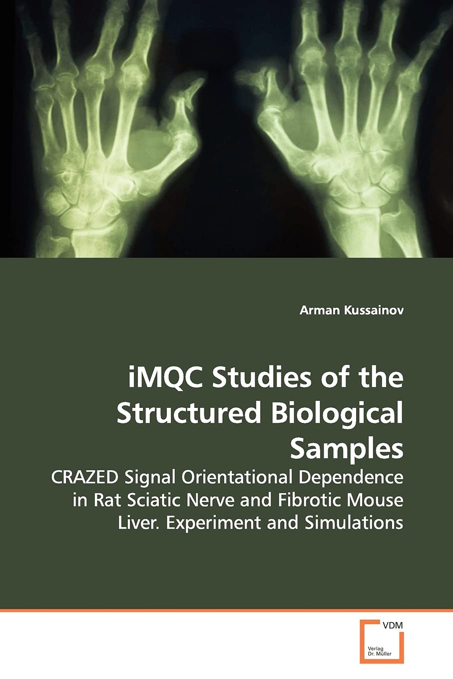 iMQC Studies of the Structured Biological Samples: CRAZED Signal Orientational Dependence in Rat Sciatic Nerve and Fibrotic Mouse Liver. Experiment and Simulations