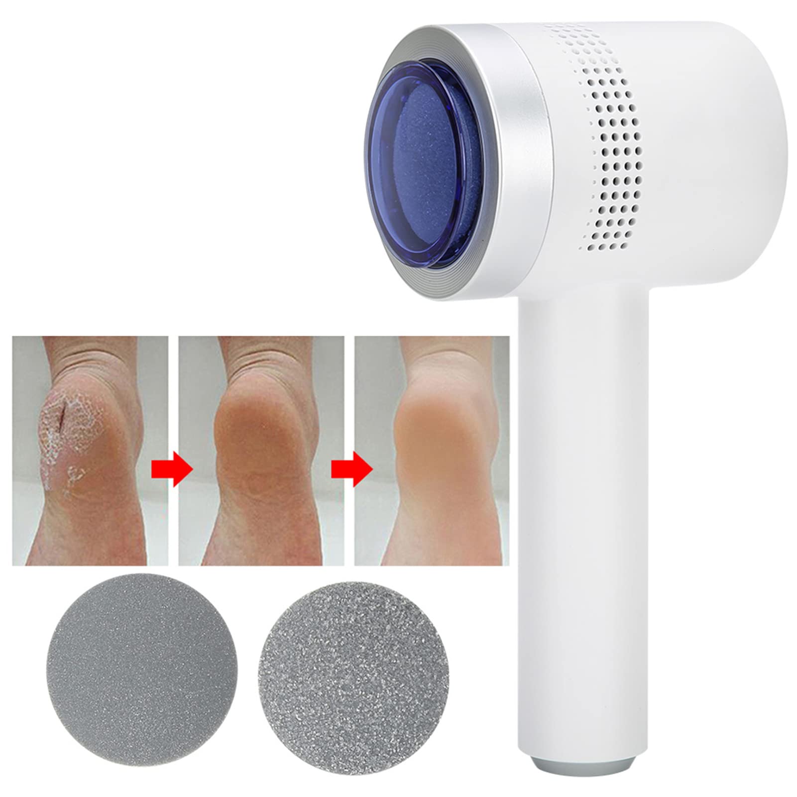 Silkn Vacupedi Removedor de Maíz para Pies 23 × 15 × 8 Herramienta de Pedicura Recargable por USB Eliminador Automático de Callos y Piel Muerta Lima de Pie Ajustable
