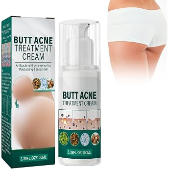 Butt Acne Cream Anti Pimple Cream on the Buttocks Butt Acne Cream Butt Anti-Pimple Serum Acne Cream for the Buttocks Butt Pimple Removal Cream Restore Soft and Smooth Butt Skin 100 ml A