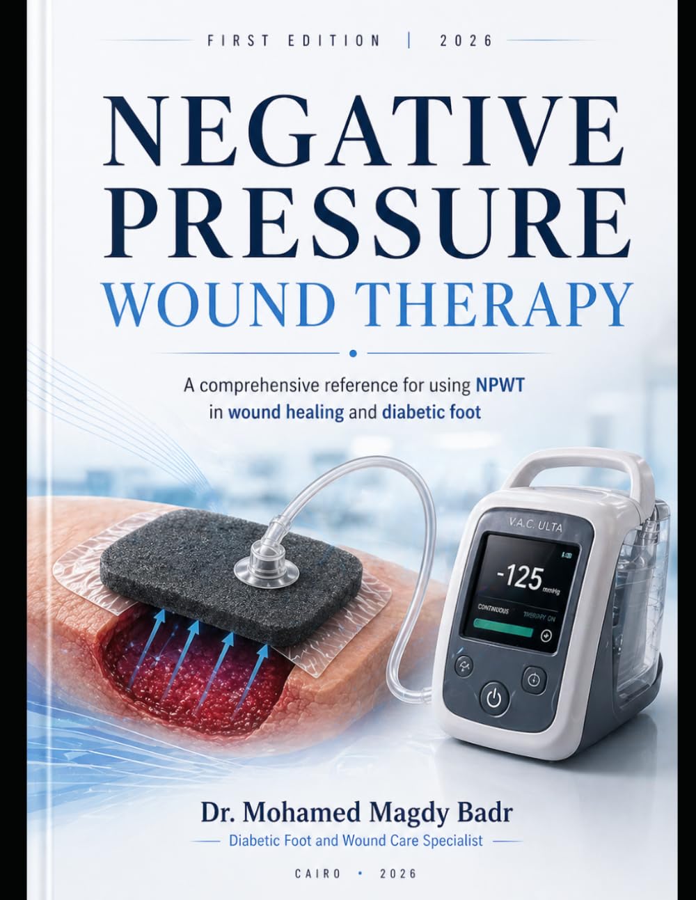 NEGATIVE PRESSURE WOUND THERAPY: A Comprehensive Reference for Using NPWT in Wound Healing and Diabetic Foot