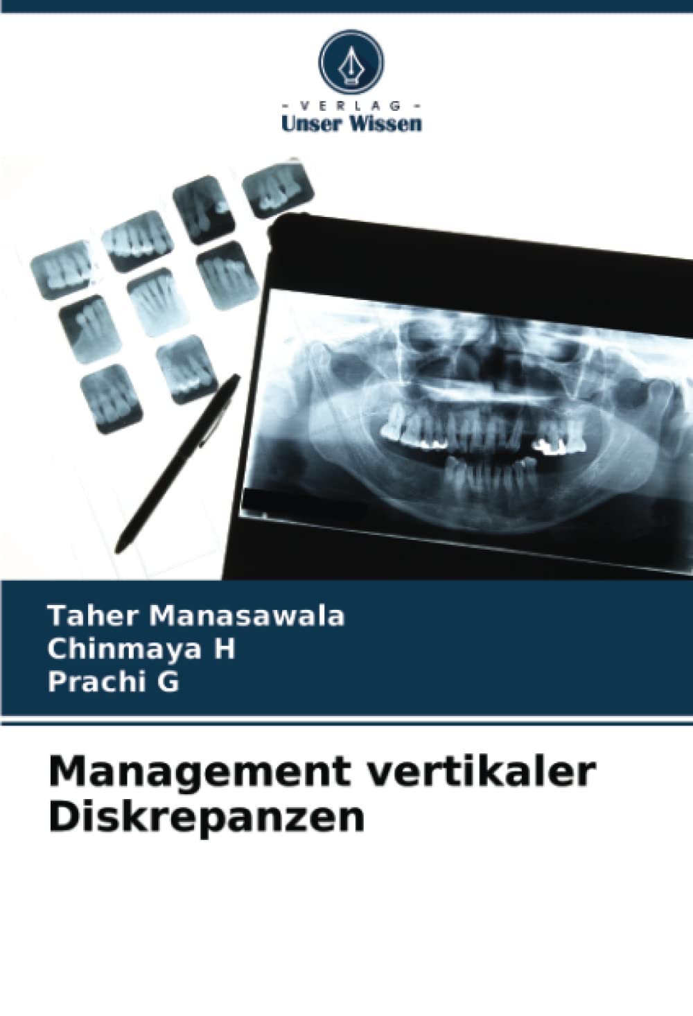 Management vertikaler Diskrepanzen