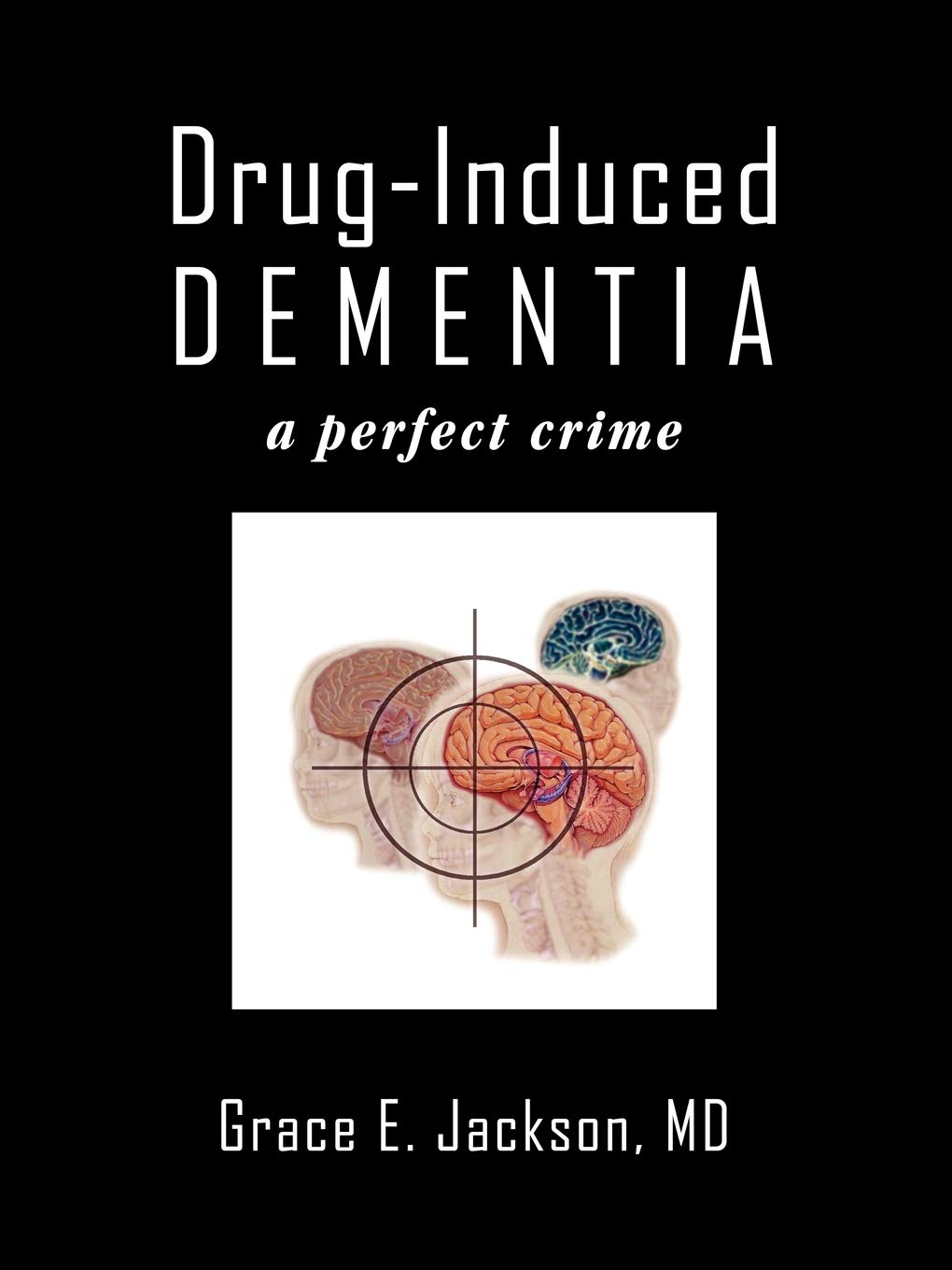 Drug-Induced Dementia: a perfect crime Paperback – May 31, 2009
