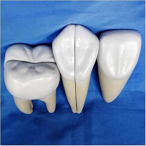 Miniatura 1 de HEYBEC Medical Models, Tooth Model Dental Implant Teeth Anatomy Model Study Teach Standard Model Human Anatomical Model