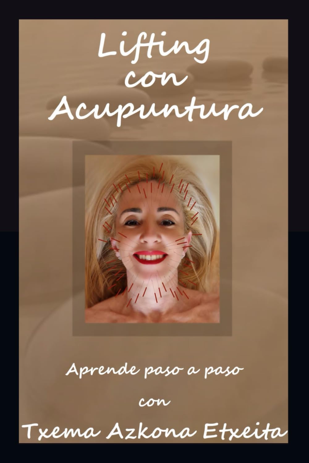 Lifting con Acupuntura. Aprende paso a paso con Txema Azkona Etxeita