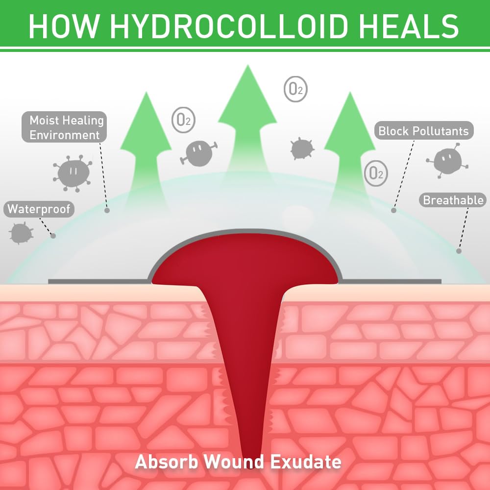 Hydrocolloid Roll,Cerotti Idrocolloidali Idrocolloide Rotolo Autoadesivi e Traspirante Nastro Idrocolloidale Rotolo Impermeabili (verde, 5x500cm)