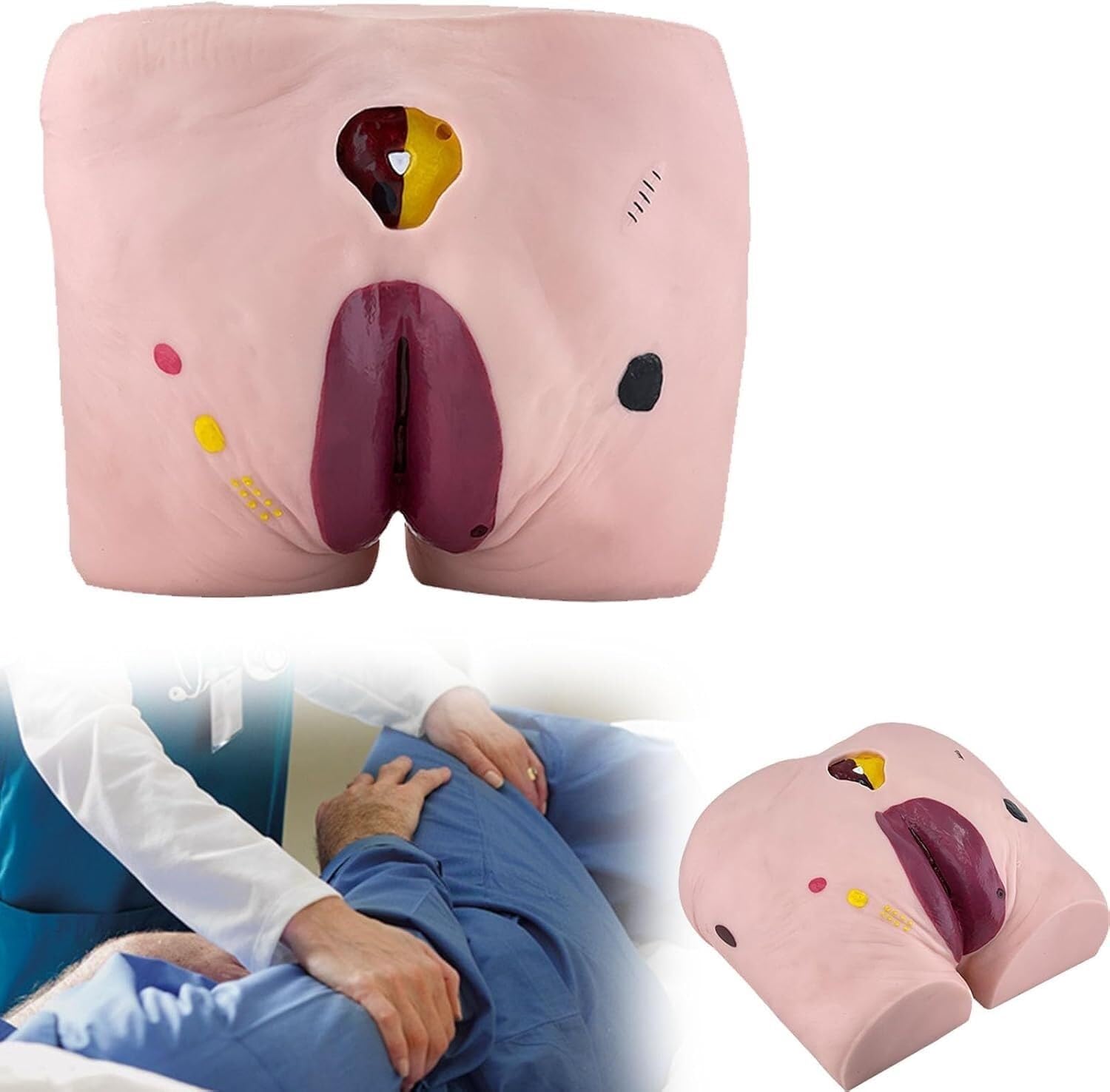 HEQIM Bedsore Ulcer Care Model 4 Stages, Bedsore Care Model, Bedsore Wound Model, Practice Cleaning Basic Nursing Techniques Practical Science Classroom Learning Display