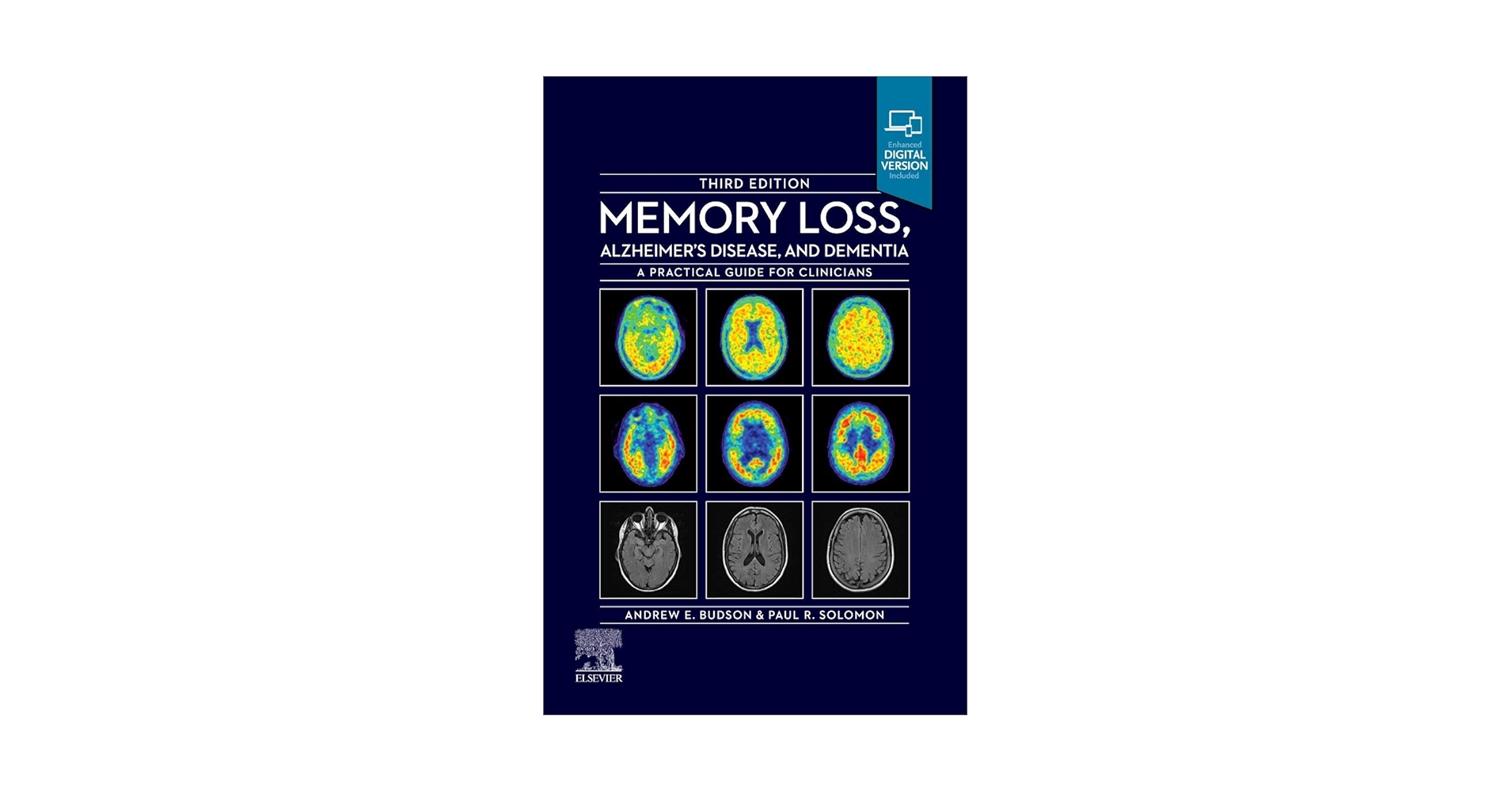 Memory Loss，Alzheimer&#39;s Disease and Dementia: A Practical Guide for Clinicians [ペーパーバック] Budson MD，Andrew E.; Solomon PhD，Paul R. Memory Loss, Alzheimer's Disease and Dementia: A Practical