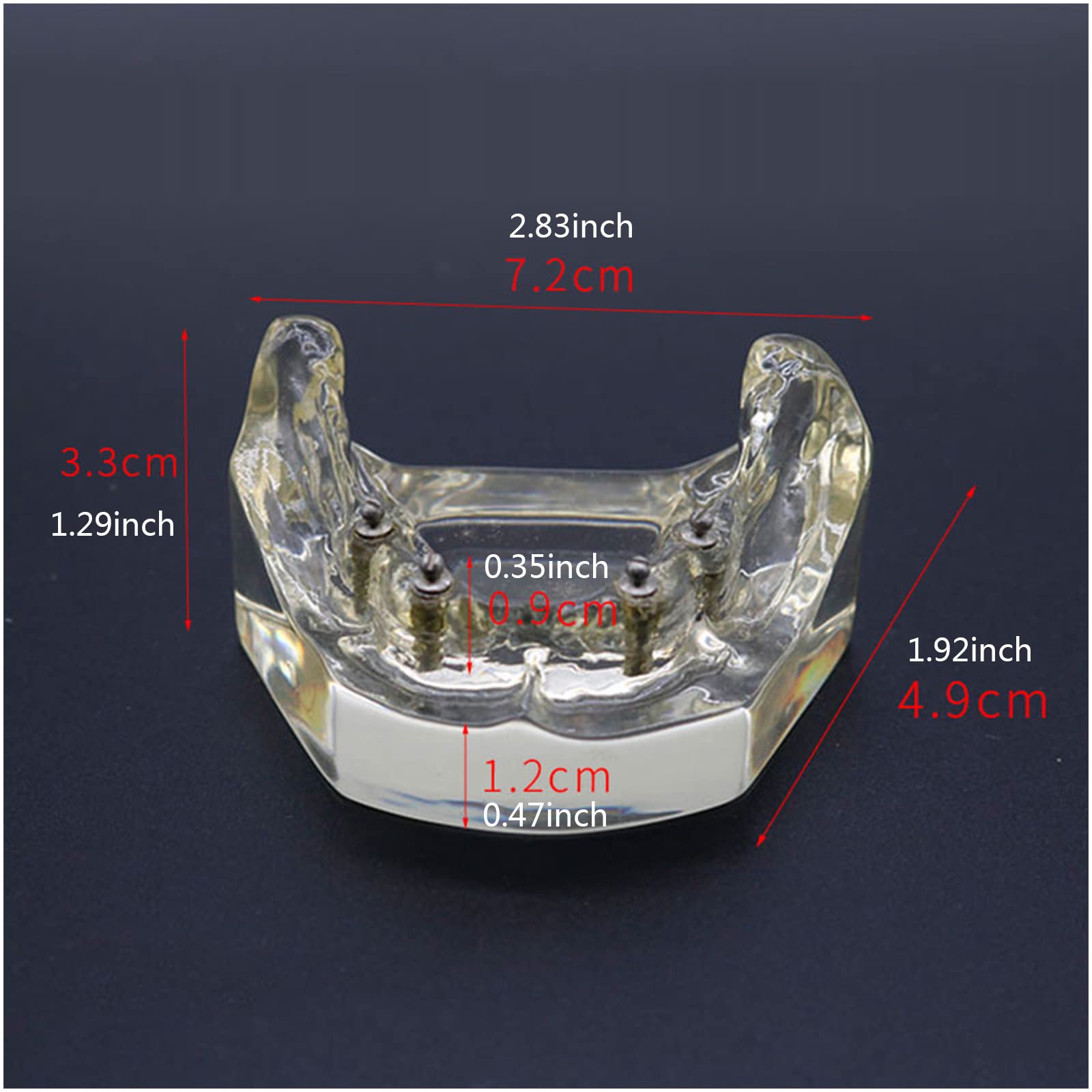 Implant Typodont model zębów - model szkoleniowy implantu dentystycznego - z miękkimi dziąsłami, do nauczania przedmiotów ścisłych, narzędzie komunikacji lekarz-pacjent (B)