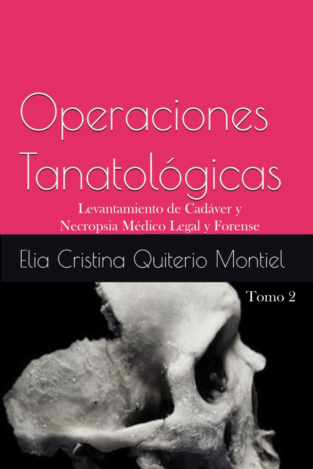 Operaciones Tanatológicas: Tomo 2 Levantamiento de Cadáver y Necropsia Médico Legal y Forense