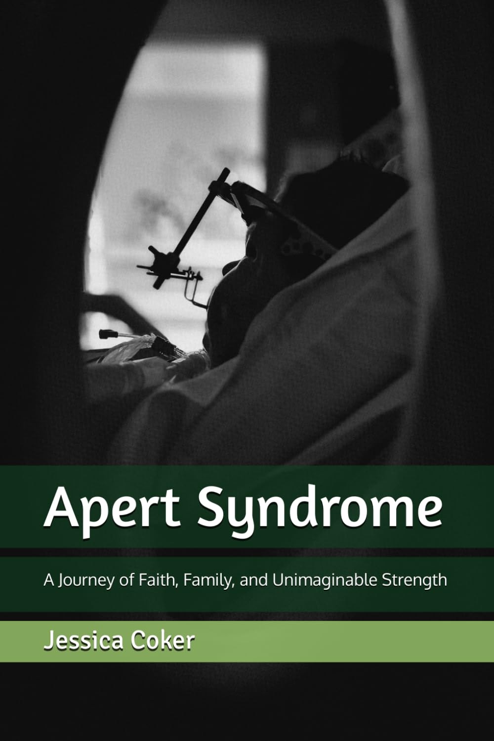 Apert Syndrome: A Journey of Faith, Family, and Unimaginable Strength