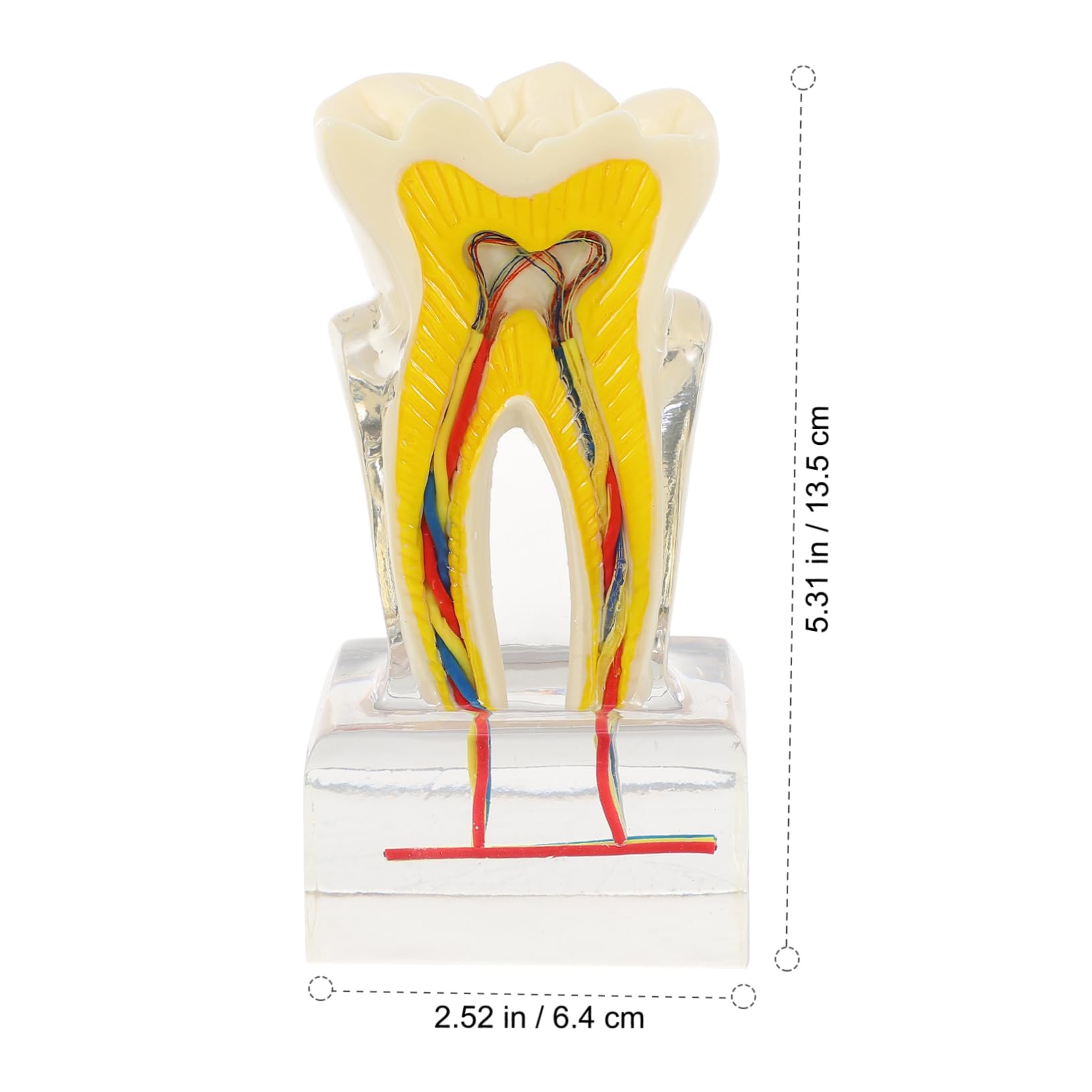 PRETYZOOM 6volte Modello Di Denti Dentali Modello Di Studio Per Per Lezioni Di Odontoiatria Dimostrazione Di Impianto e Protesi Fissa