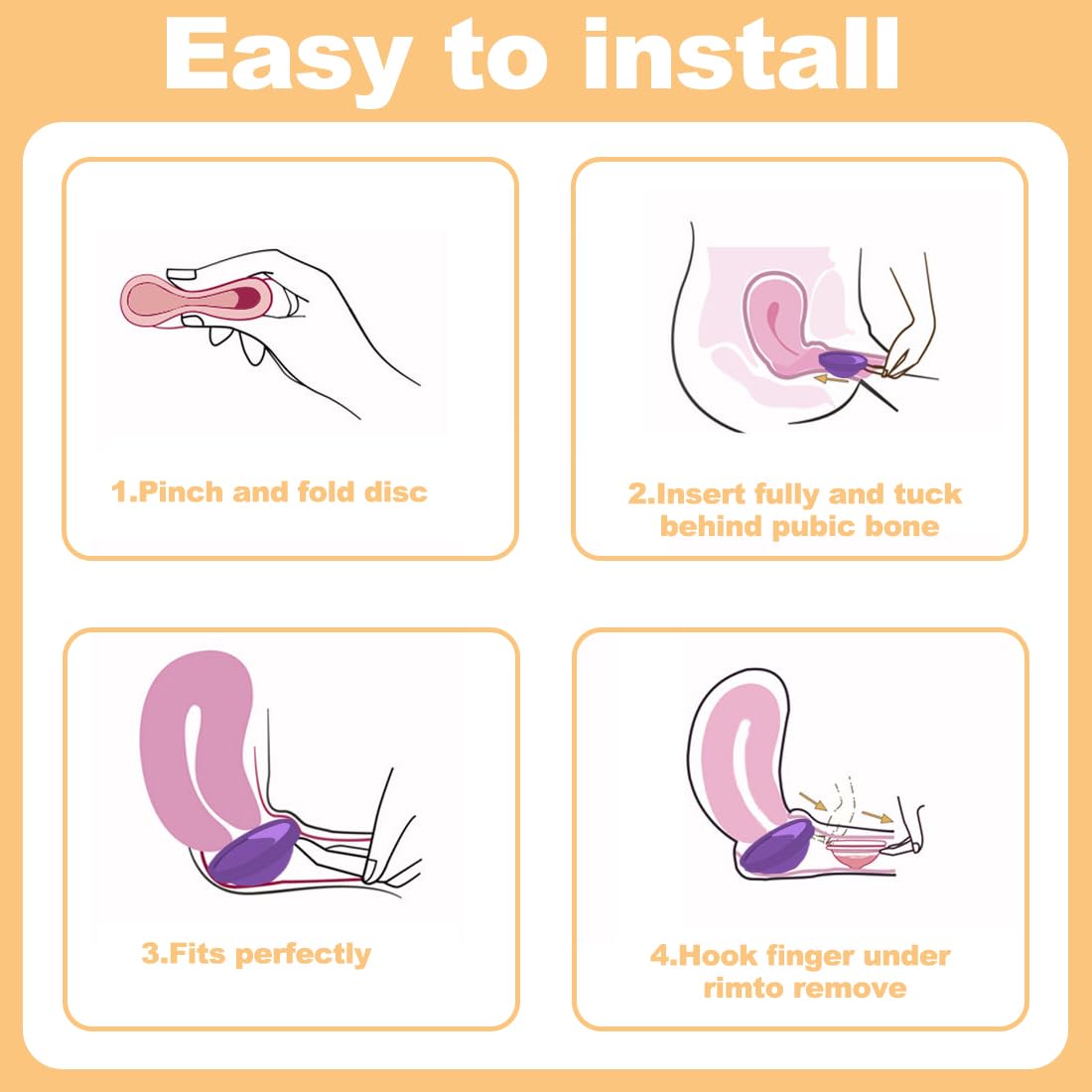 IKOPFLN 2 pezzi di disco mestruale, disco mestruale riutilizzabile, coppetta mestruale, tazze mestruali a prova di perdita realizzate in silicone, per donne sport attivi（S+L, Rosa + Viola