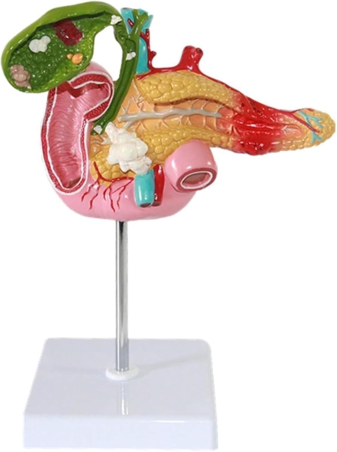 Digestive System Anatomy Teaching Model Human Pancreas Duodenum Gallbladder Pathological Medical