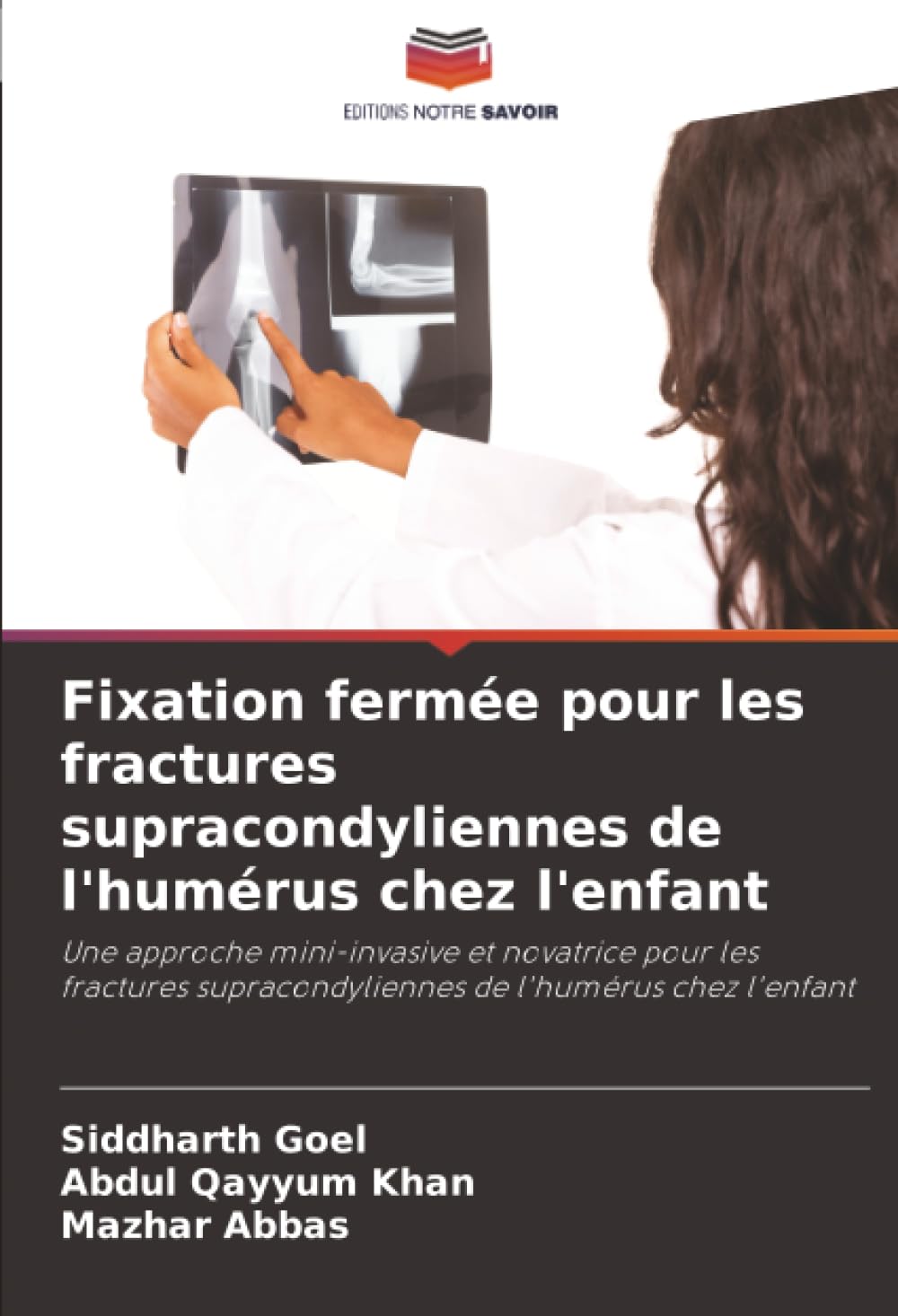 Fixation fermée pour les fractures supracondyliennes de l'humérus chez l'enfant: Une approche mini-invasive et novatrice pour les fractures supracondyliennes de l'humérus chez l'enfant