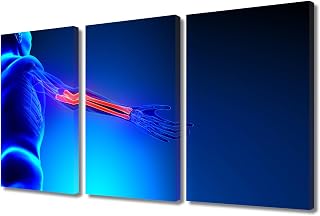 3 Pieces Skeleton X-Ray 3D Poster Canvas Wall Art Radius Ulna Bones Anatomy Medical Concept Artwork Contemporary Modern Artwork Pictures Print on Canvas Framed Ready to Hang 24"Wx36"H