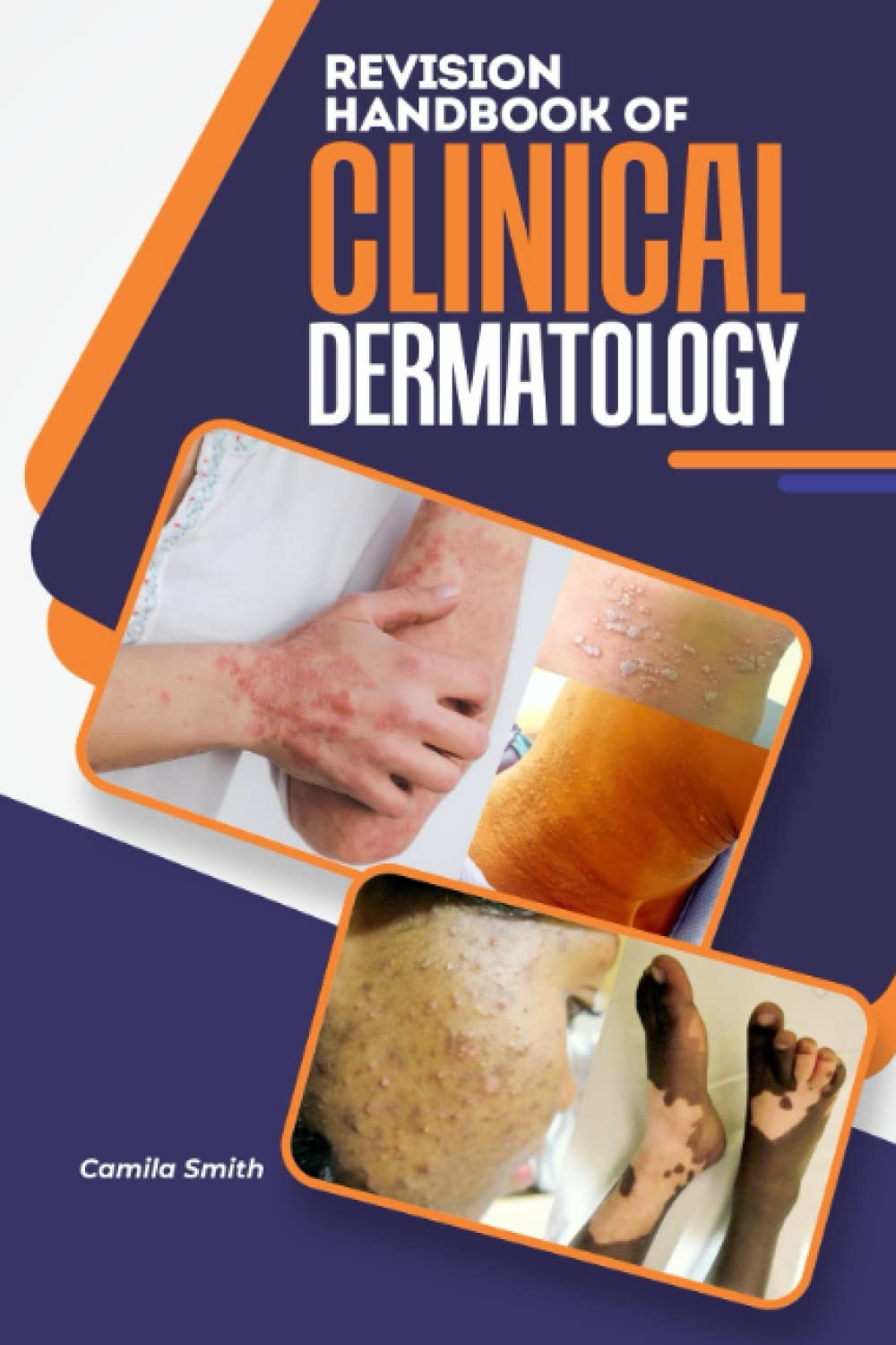 REVISION HANDBOOK OF CLINICAL DERMATOLOGY: A Short, Quick and Comprehensive summary and Reference note of Skin Diseases