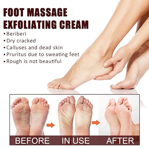 Miniatura 3 de Ingzy Crema reparadora de pies de manteca de karité, ungüento curativo de la piel para talones agrietados y pies secos Crema exfoliante para masaje