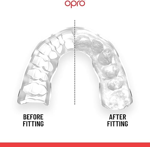 Miniatura 4 de OPRO Protector bucal instantáneo a medida, protector bucal para dentista, revolucionaria tecnología de ajuste para máxima comodidad, protección y