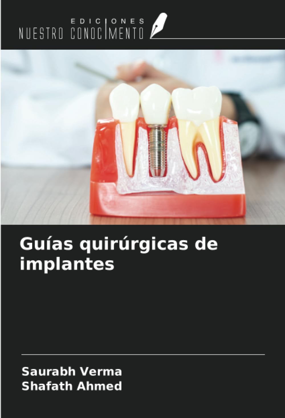 Guías quirúrgicas de implantes