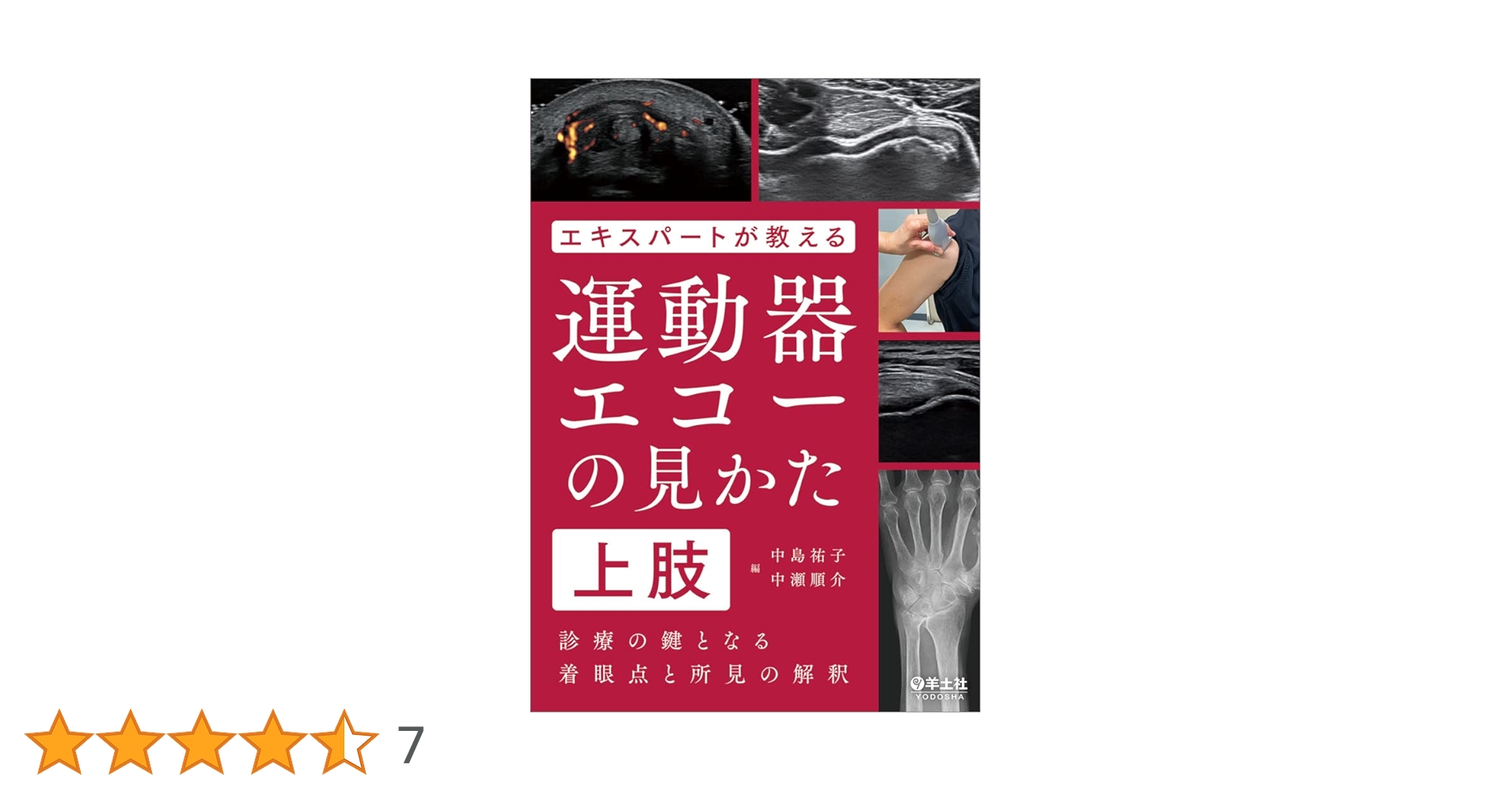 エキスパートが教える運動器エコーの見かた 上肢〜診療の鍵となる着眼