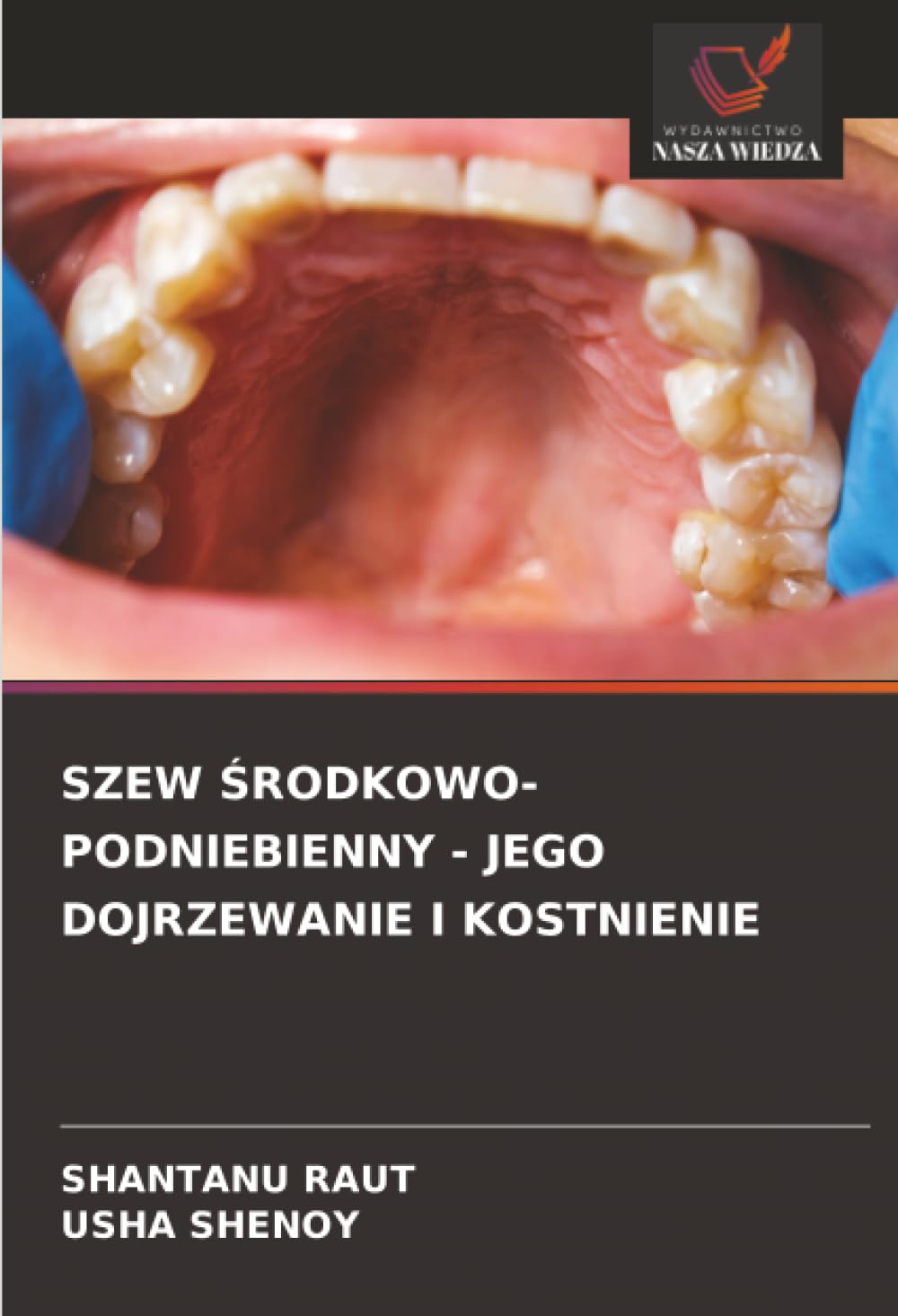 Szew Środkowo-Podniebienny - Jego Dojrzewanie I Kostnienie