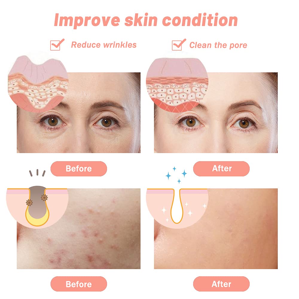 Máscara Facial LED de 7 Colores Cara Cuello Rejuvenecimiento de Fotones Máquina de Belleza Mascarilla Tonificante Antiarrugas para Reafirmar la Piel para Salón de Uso Doméstico