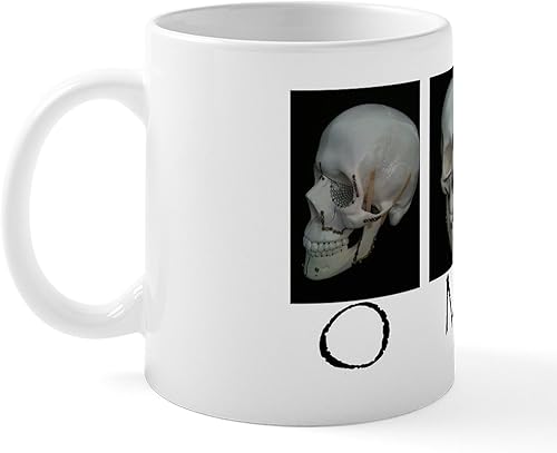 Miniatura 2 de CafePress OMS Surgical Skull Mug 11 oz (325 ml) Ceramic Coffee Mug