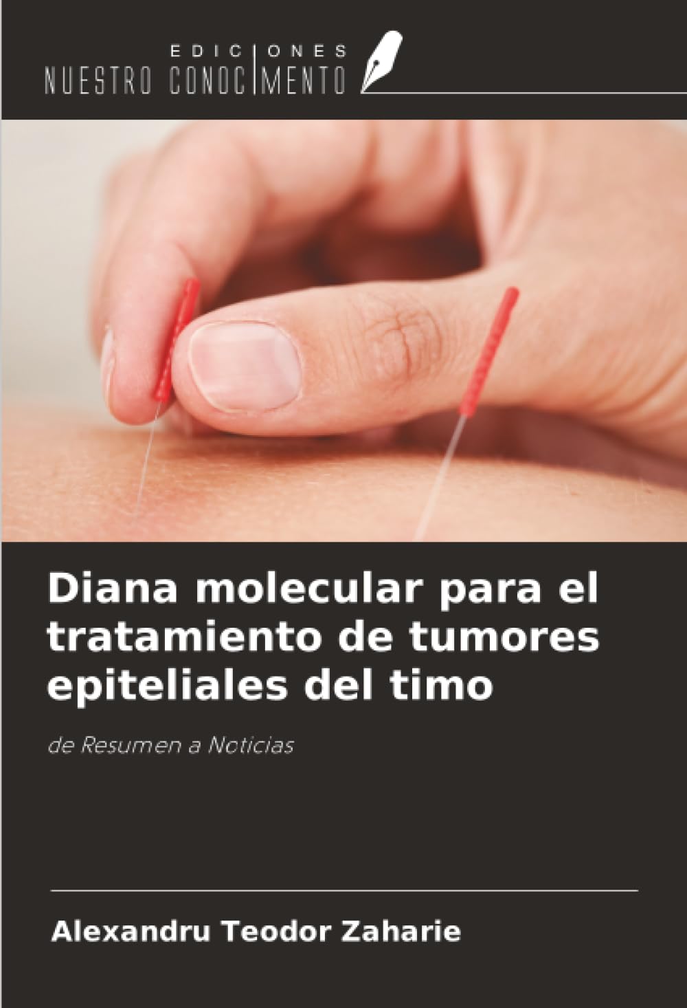Diana molecular para el tratamiento de tumores epiteliales del timo: de Resumen a Noticias