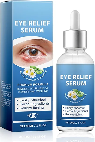 S_tye Eye Treatment Serum, Eye Relief Serum for Blepharitis and Eyelid Bumps, Fast -Acting Chalazion Remover, Natural Formula S_tye Eye Serum for Soothing Dryness & Relieving Irritation, 30mL