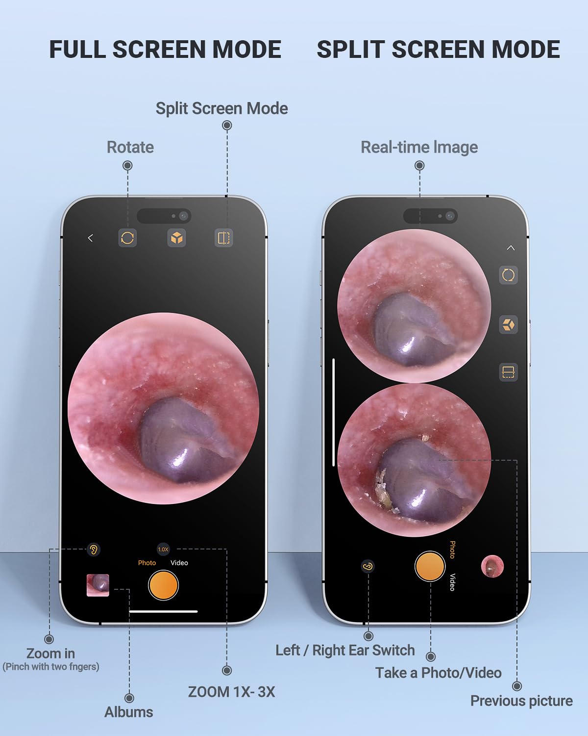 Digitales Otoskop Kompatibel mit iPhone und Android-Geräten, HD Ohrkamera mit Ohrenschmalz-Entfernungswerkzeugen, Video Ohrfernrohr Otoskop mit Licht, Aufnahme von Fotos und Videos (Lila)