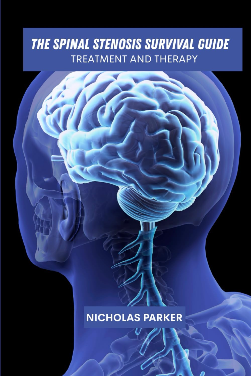 The spinal stenosis survival guide: Treatment and therapy