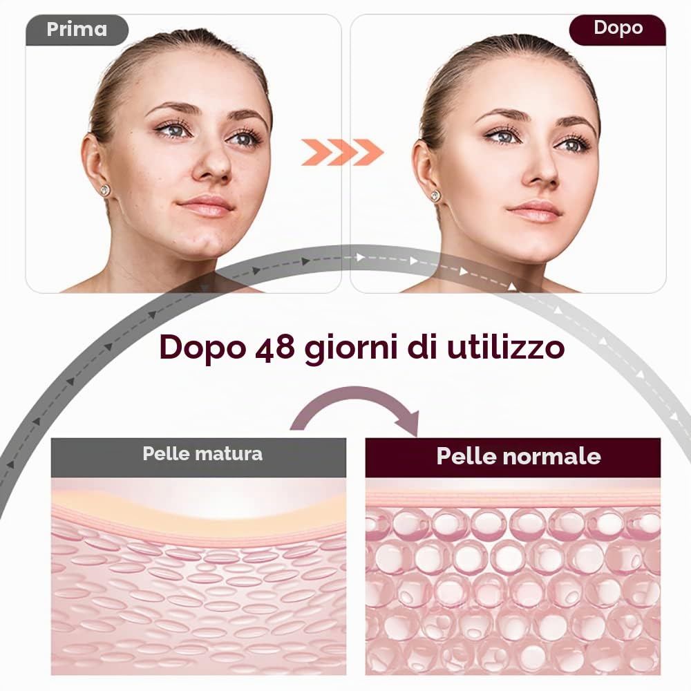 Dispositivo di Bellezza 3 IN 1 RF EMS MINI HIFU Portatile Ringiovanimento della Pelle con Lifting Facciale Macchina di Bellezza per la Cura Della Pelle del Viso