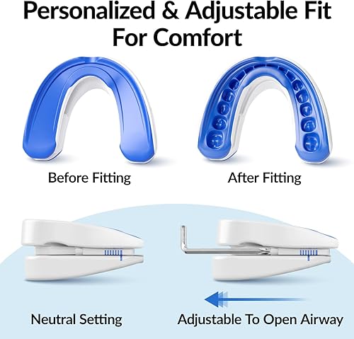 Miniatura 2 de VitalSleep - Protector bucal antironquidos para hombre, dispositivo ajustable para ronquidos, dispositivo antironquidos personalizado con máscara de