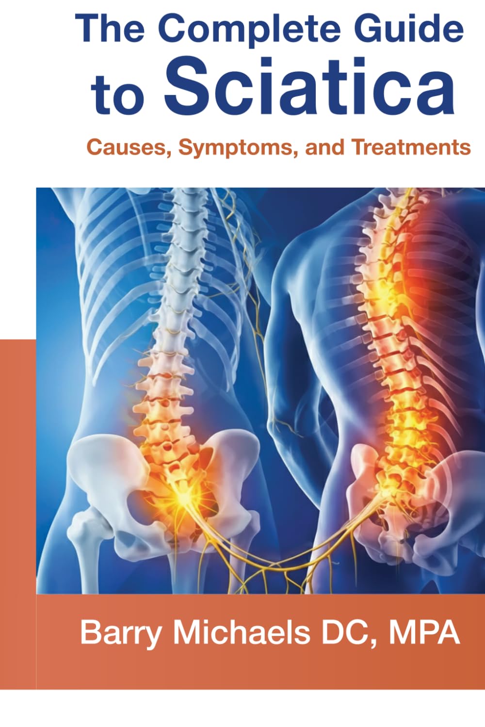 The Complete Guide to Sciatica: Causes, Symptoms, and Treatments (SERIES 2 — The Pain & Relief Essentials Understanding common sources of pain and practical ways to manage them.)