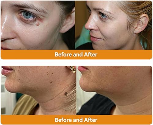 Miniatura 3 de AAFQ Bee Venom Treament & Removal Crema, hidratantes faciales y reparación de la piel para hombres y mujeres, 1.0 fl oz (1)