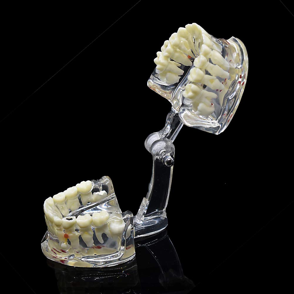 Angzhili Teeth Model Kids,Transparent Dental Demonstration Teeth Model,Typodont Teaching Model