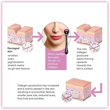 Derma Roller 1.5mm for Hair Growth| Anti Ageing Microneedling Roller for Face Body Scalp| Derma Roller for Men&Women|Micro Needling Roller 540 Titanium Needle Home Use,Acne Marks,Cellulite Treatmment.