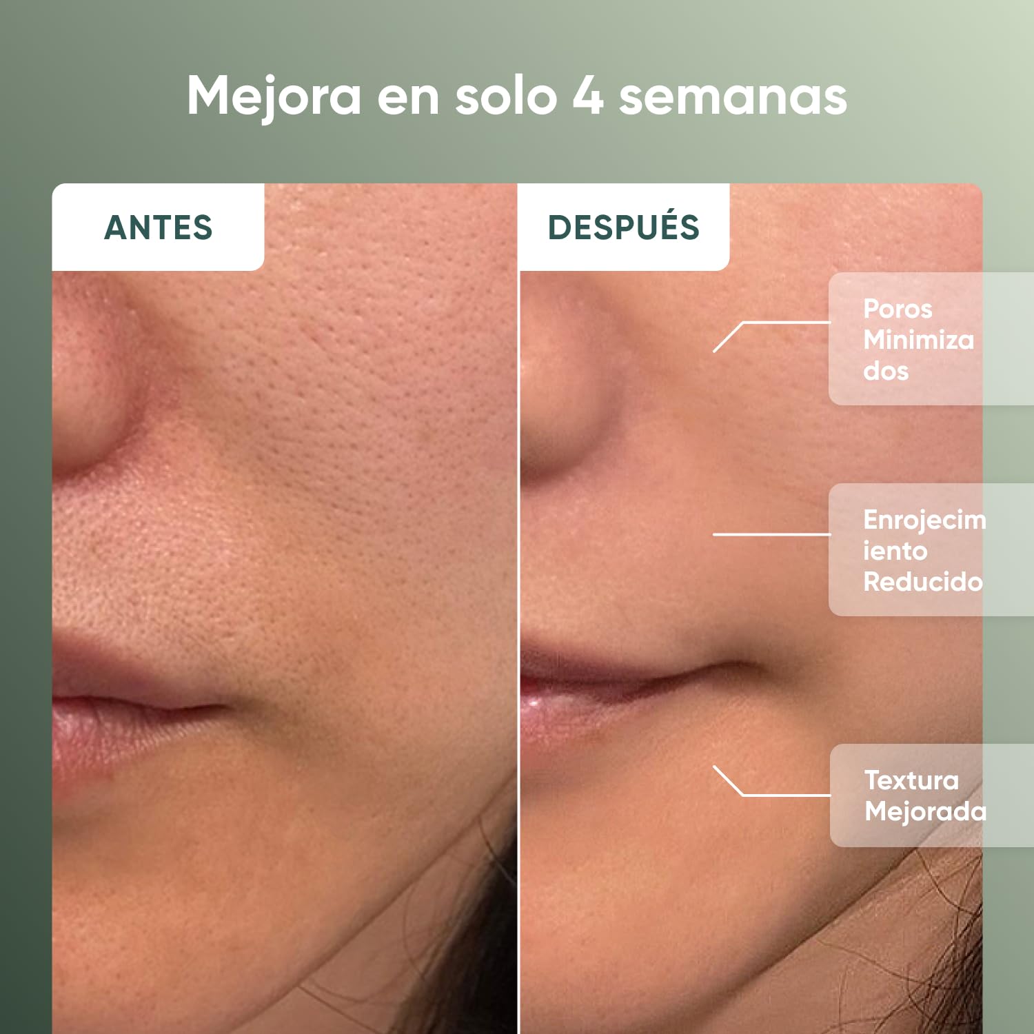 Nanoleaf Máscara LED Facial de Terapia, 7 Modos, Luz Roja Portátil con LED NIR, Silicona Suave, Protección Ocular, Mascarilla de Fototerapia 5-10 Minutos, Infrarrojo Recargable