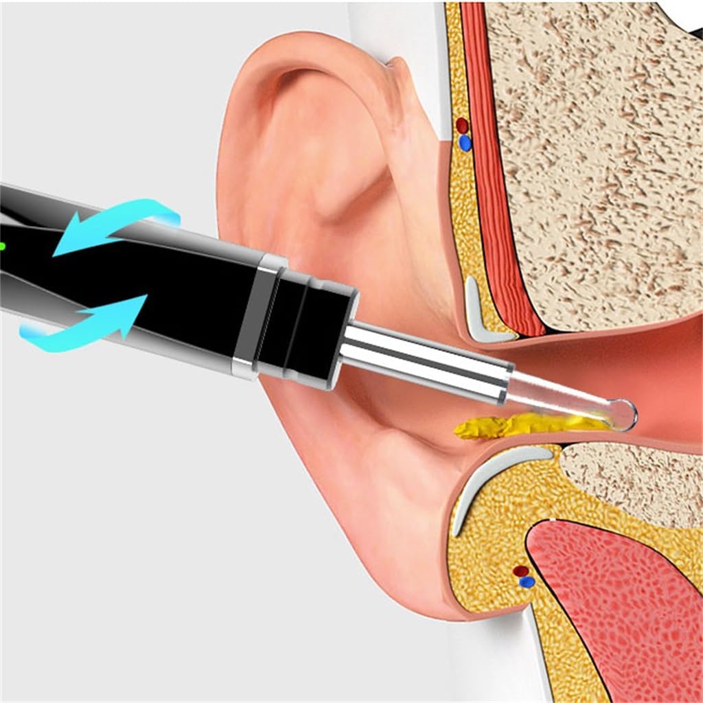 Visual Ear Digging Spoon, Intelligent Luminescent Collecting Rod, Picking