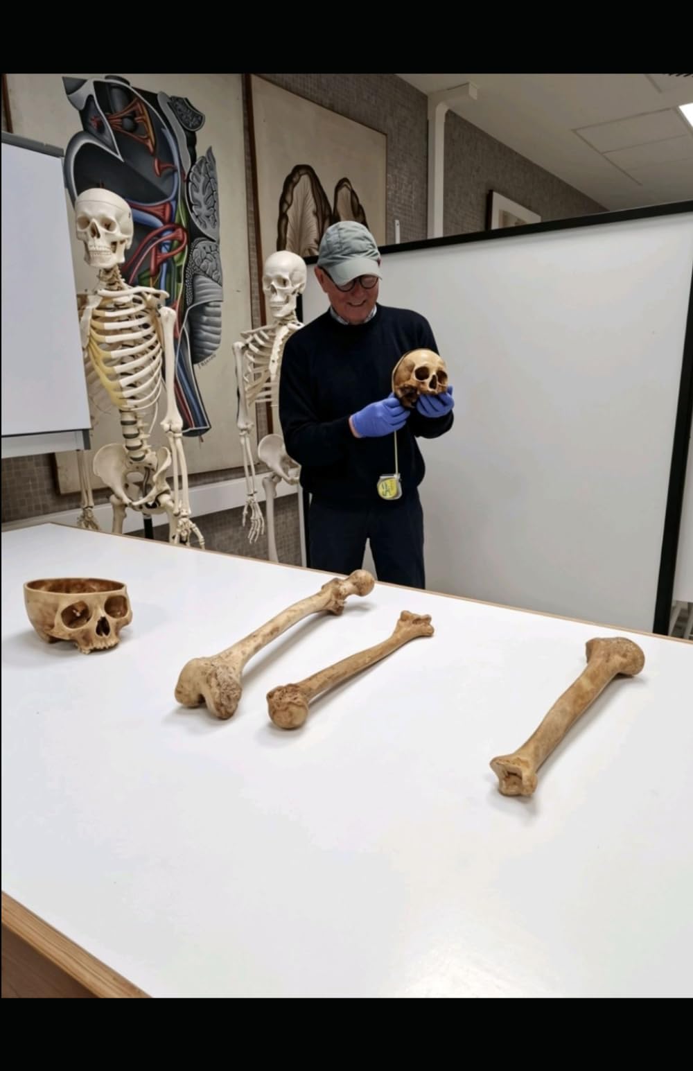 FUNDAMENTOS DE ANTROPOLOGÍA FÍSICA Y FORENSE
