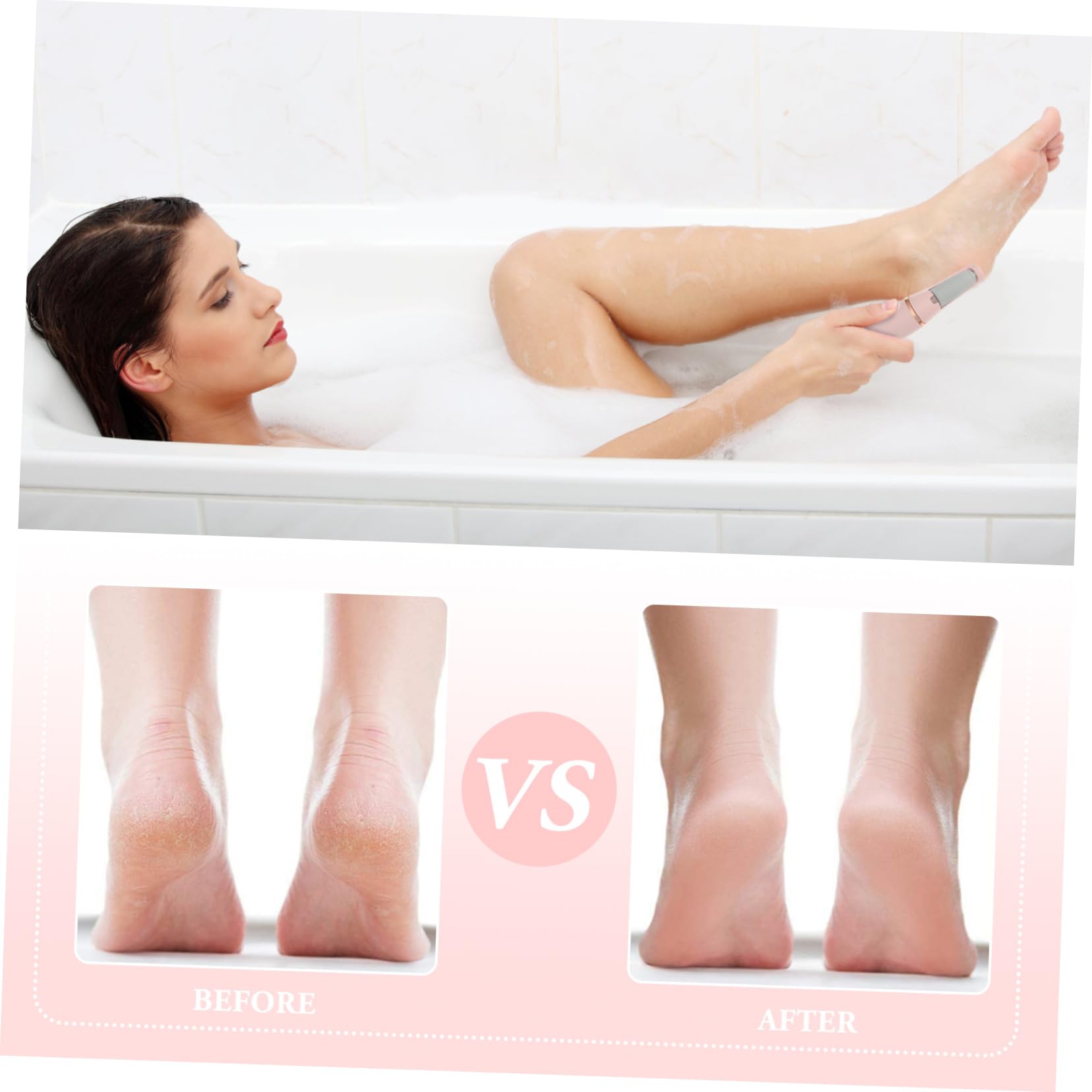 VICASKY Raspa Elettrica per Piedi, Rimuovi Calli e Pelle Morta, Portatile e Leggera in Abs, per Pedicure a Casa in Viaggio